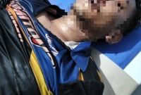Tampak korban pengeroyokan Poto Humas polres Merangin