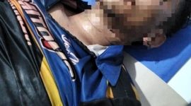 Tampak korban pengeroyokan Poto Humas polres Merangin 