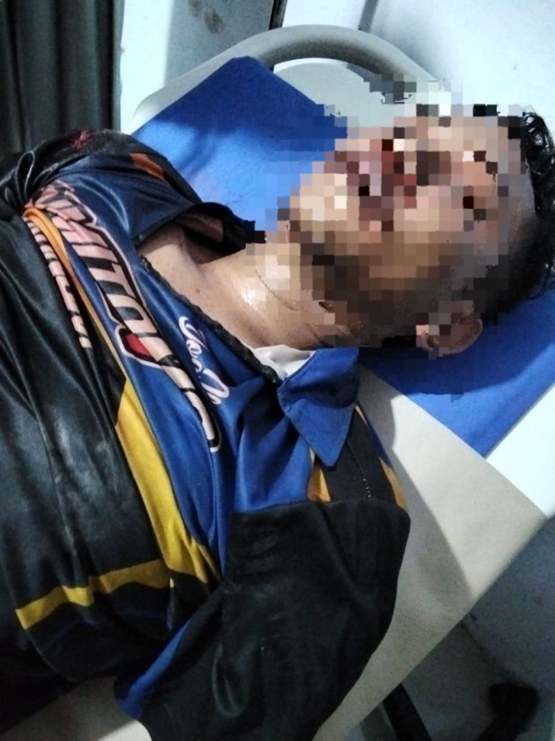 Tampak korban pengeroyokan Poto Humas polres Merangin 